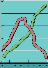 audiogram